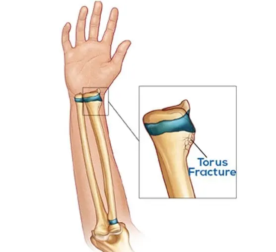 Key Benefits Diagram
