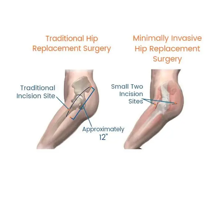 Key Benefits Diagram