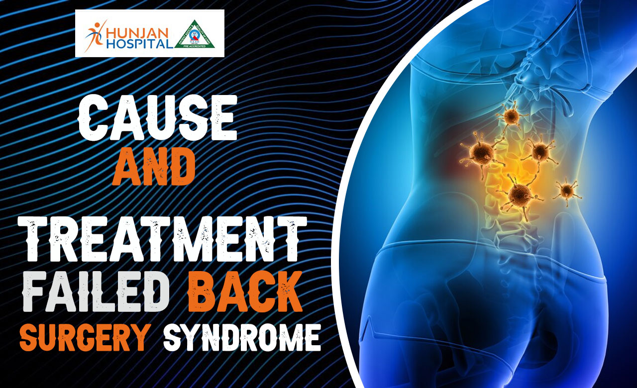 A brief note on failed back surgery syndrome.