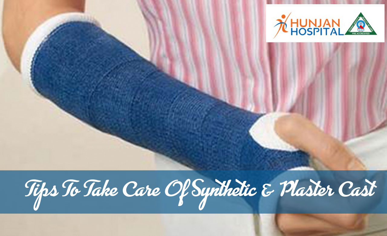 Tips To Take Care Of Synthetic & Plaster Cast